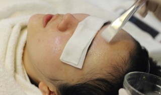 如何改善面部红血丝（如何改善面部红血丝的方法）