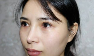 眼袋怎么去掉（照片上的眼袋怎么去掉）