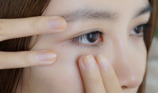 眼皮跳是什么原因怎么办（男人眼皮跳是什么原因怎么办）