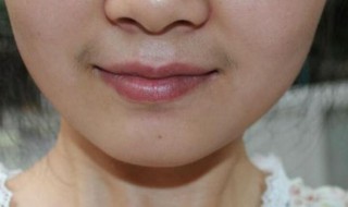 女生如何淡化唇毛 什么方法可以淡化唇毛