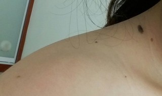 锁骨上有痣代表什么 男人锁骨上有痣代表什么