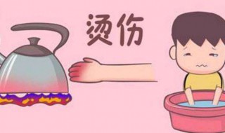 被火烫了怎么解决（被火烫了怎么紧急处理）