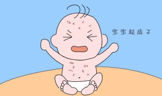 宝宝长痱子用什么擦好 宝宝长痱子用什么擦好的快