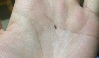 掌心有痣代表什么（女生掌心有痣代表什么）