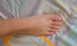 希腊脚的女人代表什么 希腊脚的女人代表什么意思