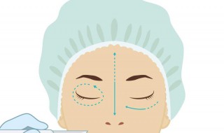 怎样能除去眼袋 怎样除去眼袋的方法