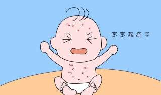 去痱子的最快方法（婴儿去痱子的最快方法）