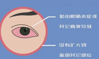 右眼跳代表什么（右眼跳代表什么意思）