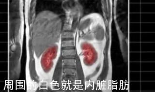 怎么知道是不是内脏脂肪多（怎么判断是不是内脏脂肪肥胖）