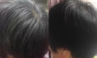 天然染黑发的方法 天然染黑发的方法自制染发