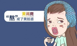 怎样治疗黄褐斑 怎样治疗黄褐斑效果最快又最好